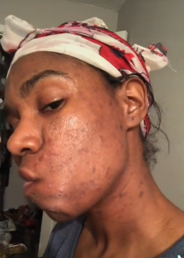 Load video: Video review of Green Tea Facial Soap, Green Tea Dark Spot Corrector and Orange Tea Scrub