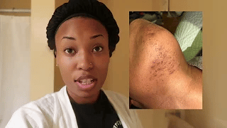 Load video: Dark spot corrector testimonial video for earthen escapes