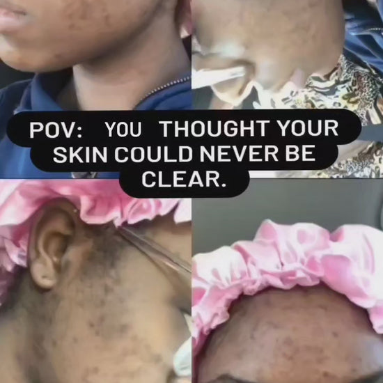 Video review of the Green Tea Dark Spot Corrector for the face