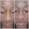 Video review of Green Tea Dark Spot Corrector for dark spots on nose
