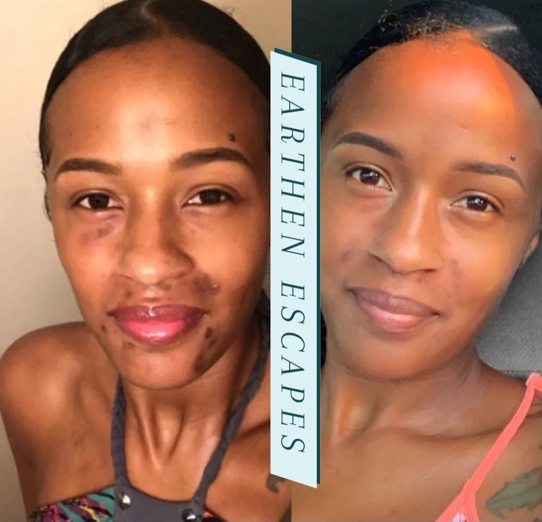 Green Tea Dark Spot Corrector Earthen Escapes